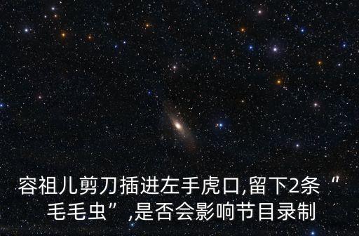 容祖儿剪刀插进左手虎口,留下2条“ 毛毛虫”,是否会影响节目录制